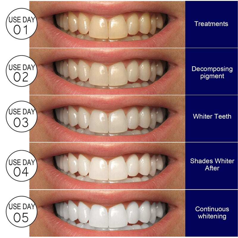 whitestrips Radiant smile Whitening Kit™