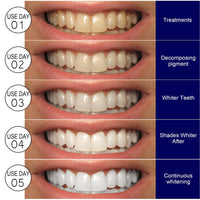 whitestrips Radiant smile Whitening Kit™